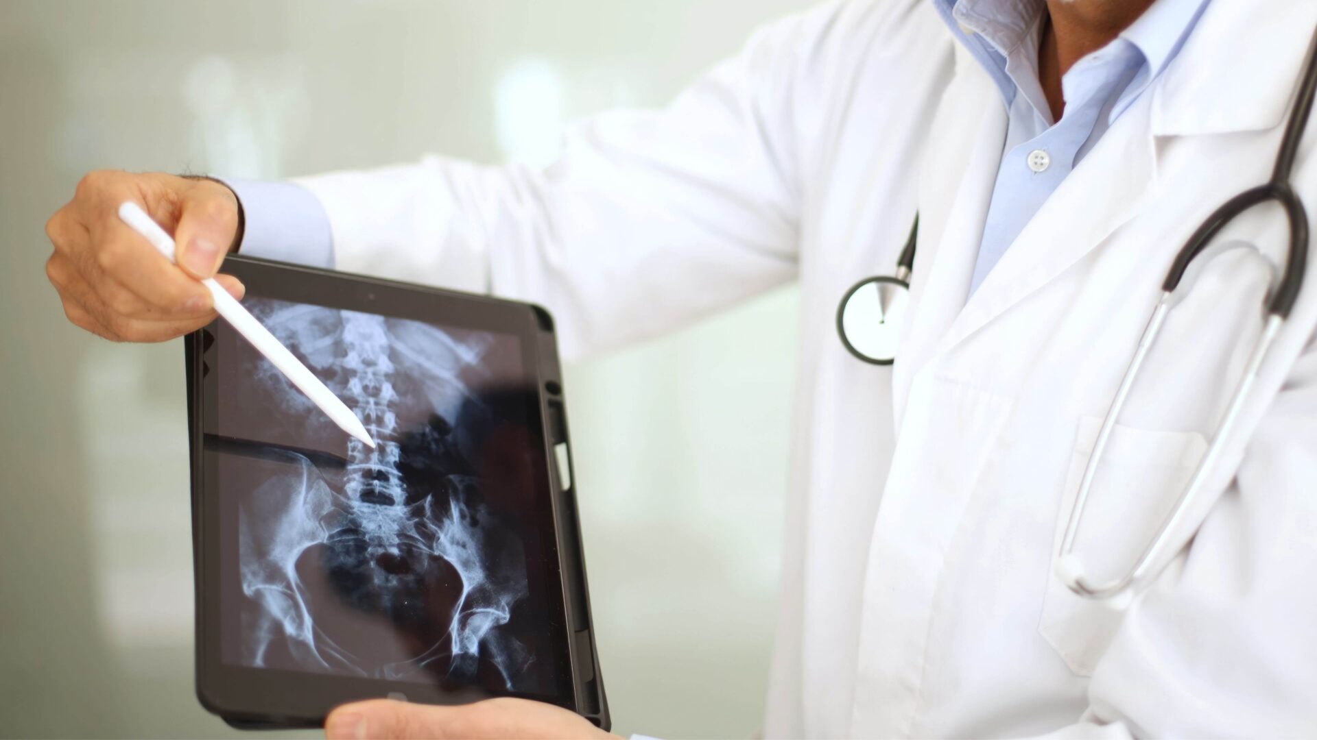 A physician wearing a white clinical coat utilizes a pen to indicate specific anatomical features on a spinal radiograph displayed on a tablet device.