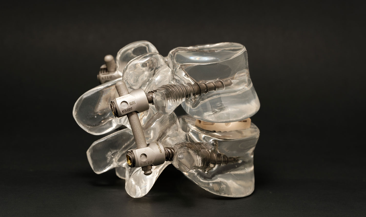 A transparent acrylic replica of the thoracic vertebral column crafted specifically for neurosurgical elucidation.