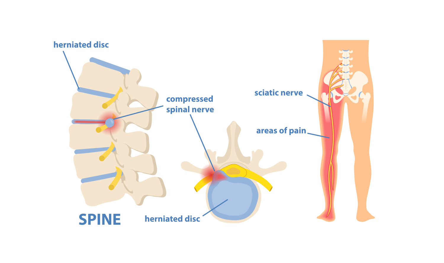 Anatomical Overview of the Vertebral Column and Its Constituent Components.