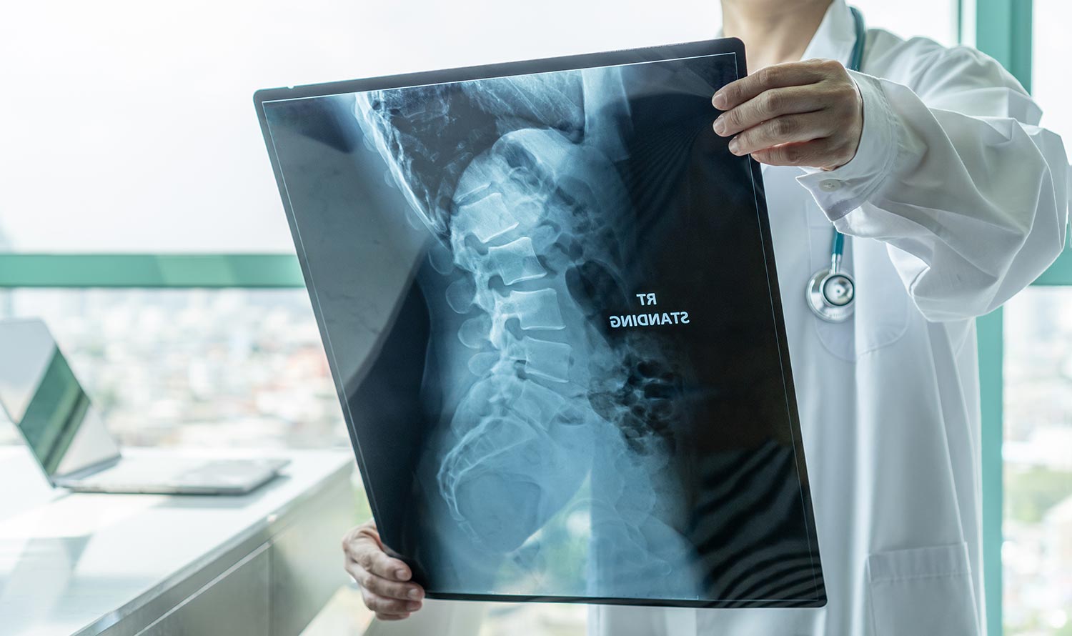 A neurosurgeon is demonstrating a patient's spinal x-ray.